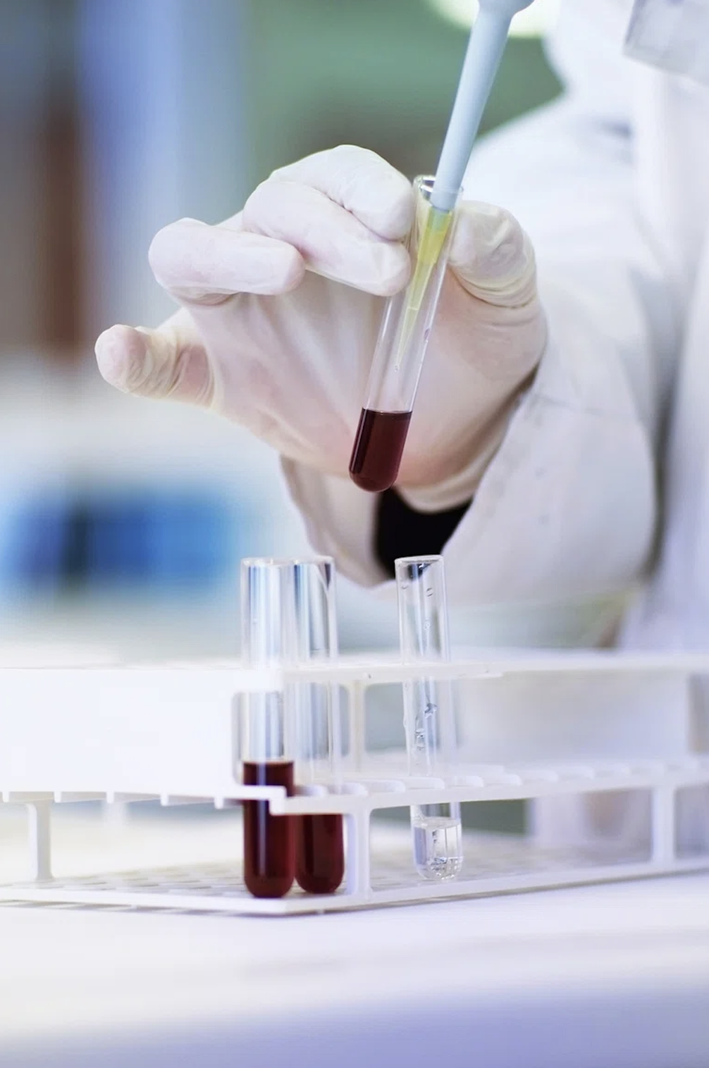 hand with blood in vial in a lab